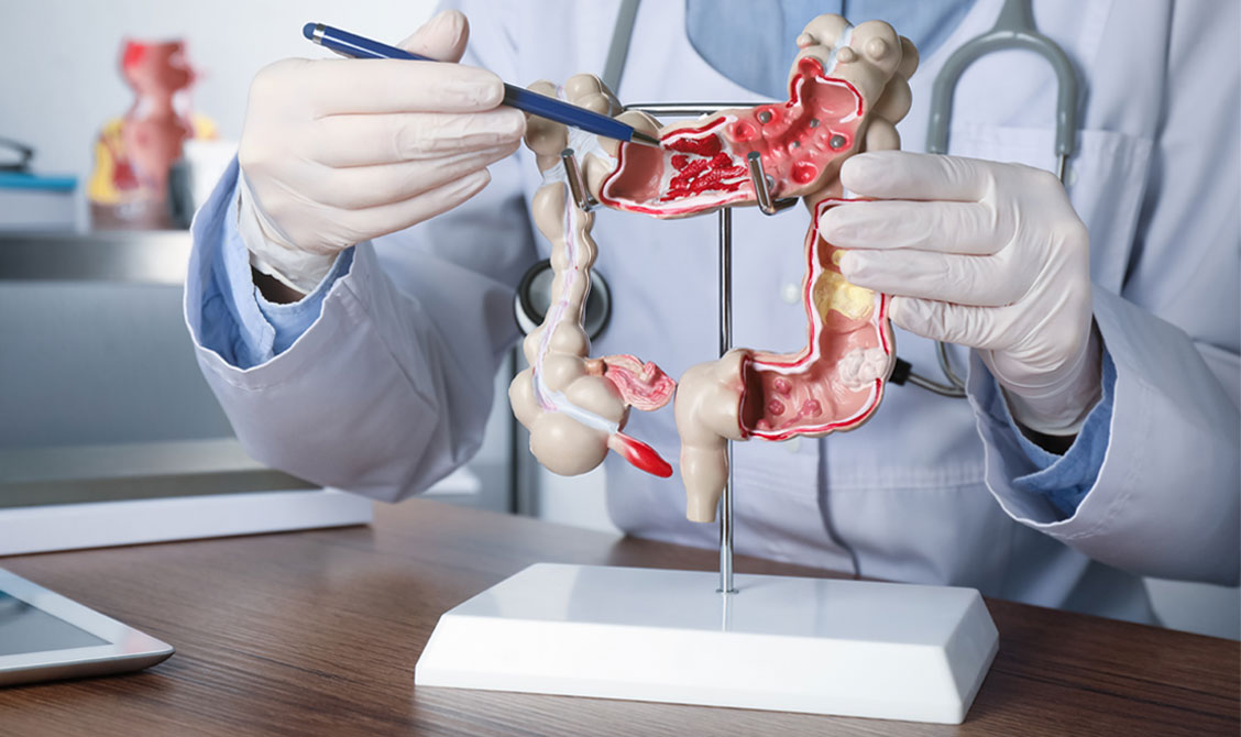 Gastrointestinal Issues